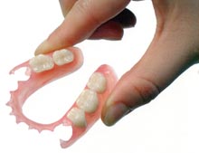 水野歯科クリニック　入れ歯　柔軟で割れにくいスーパーポリアミド樹脂使用02